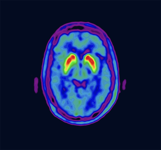 Nucleis Brain analysys scan